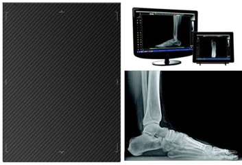Tiger DR DrTech MARS iRay Podiatry Digital Imaging System Cesium CSi Wi-Fi Weight Cap TV1012DR-WI