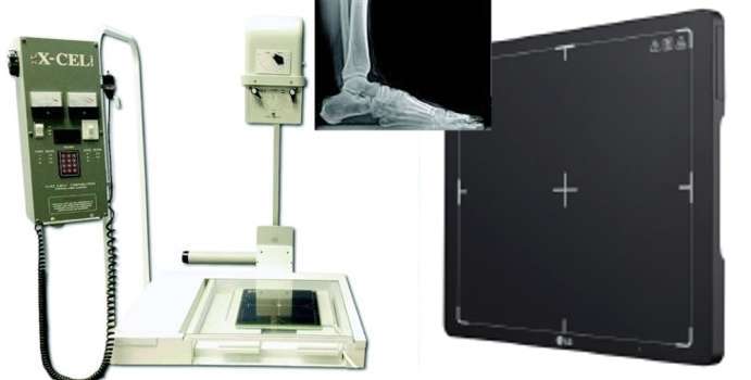 Tiger DR Podiatry Digital X-Ray Imaging System Retrofit Base Cesium LG 10x12 Wi-Fi Wireless TV1012DR-RWL